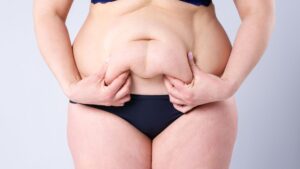 warning signs after tummy tuck