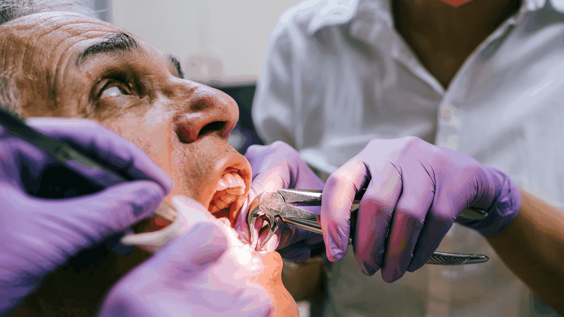 how painful is tooth extraction without anesthesia