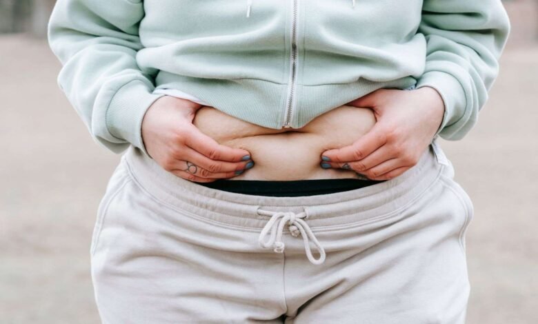 tummy tuck muscle repair failure symptoms