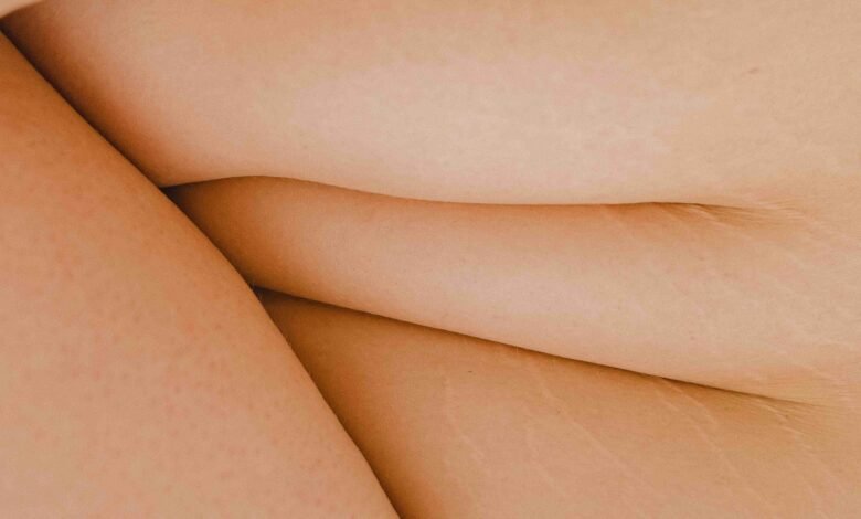 How Invasive is Tummy Tuck?